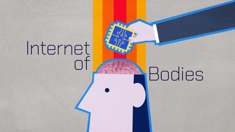 Paradromics gears up to test its brain implant on humans